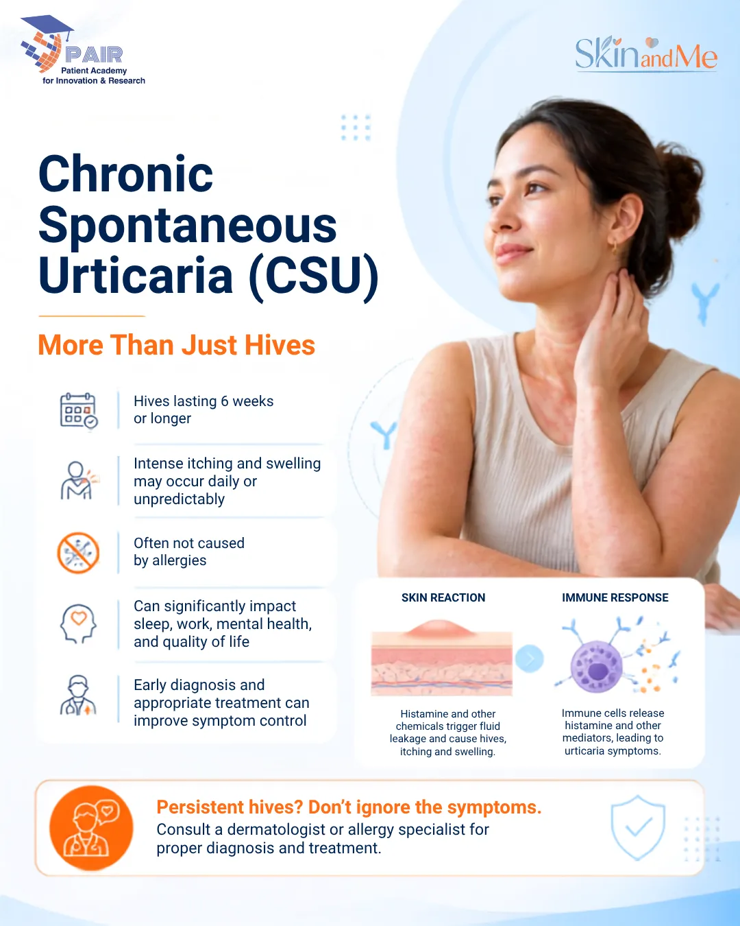 Infographic: Chronic Spontaneous Urticaria (CSU) — More than just hives, key facts about symptoms and diagnosis.